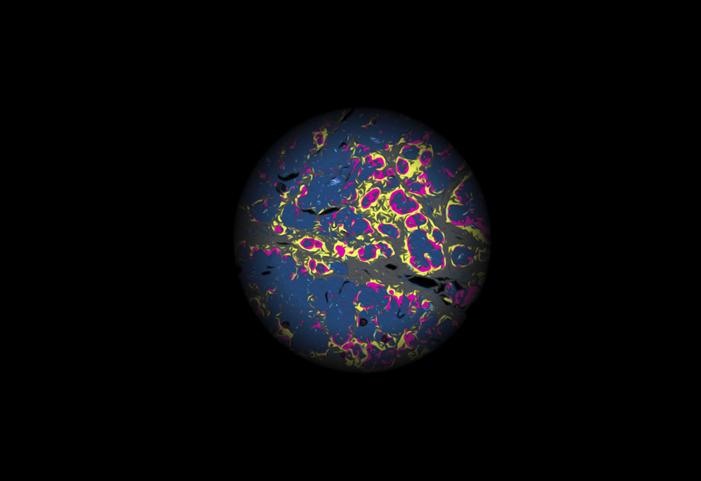 Cette découverte offre un aperçu de l'écosystème complexe du microenvironnement tumoral et offre une nouvelle perspective sur le traitement du cancer, en particulier dans le domaine de l'oncologie.