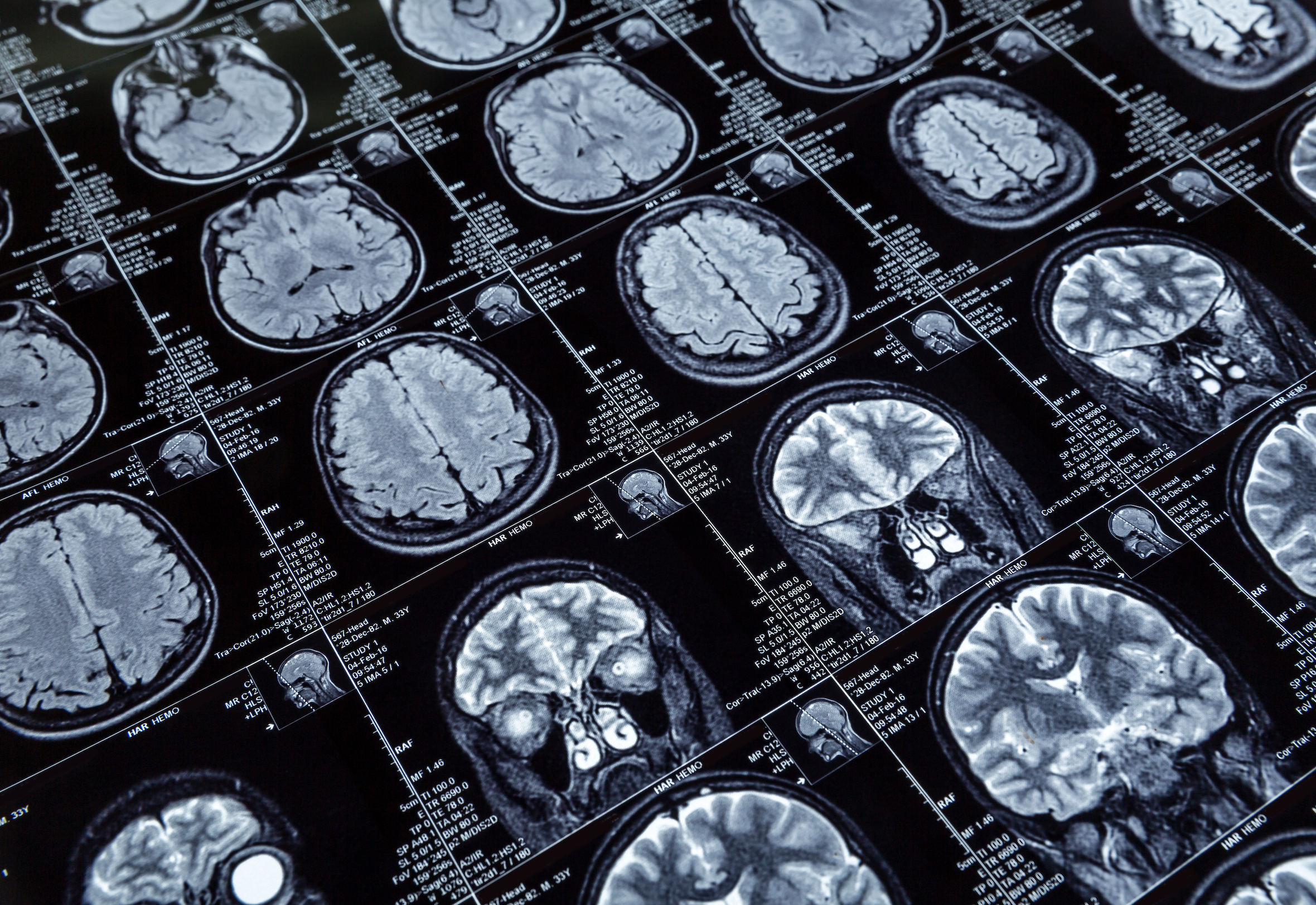 Multiwave est sur le point d'obtenir l'approbation de la FDA pour MGNTQÔ, son dispositif présenté comme l'appareil d'IRM portable le plus léger au monde.