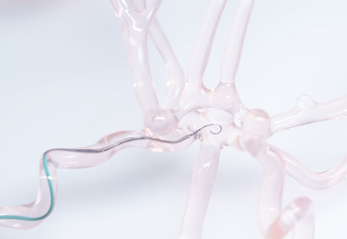 Artiria Medical’s deflectable guidewire provides an actively deformable tip and enhanced dynamic in-situ control resulting in seamless access to neurovascular targets.
