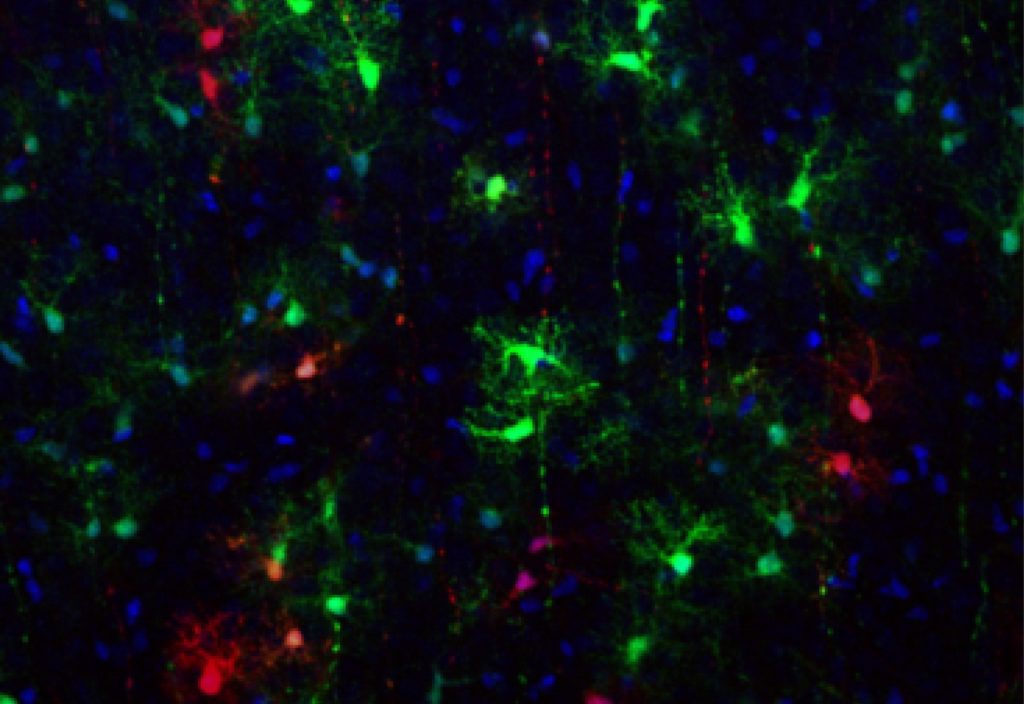 Researchers at the University of Geneva have uncovered that astrocytes in the brain’s cortex originate from two distinct types of progenitors, a finding that could reshape therapeutic strategies for neurological disorders.