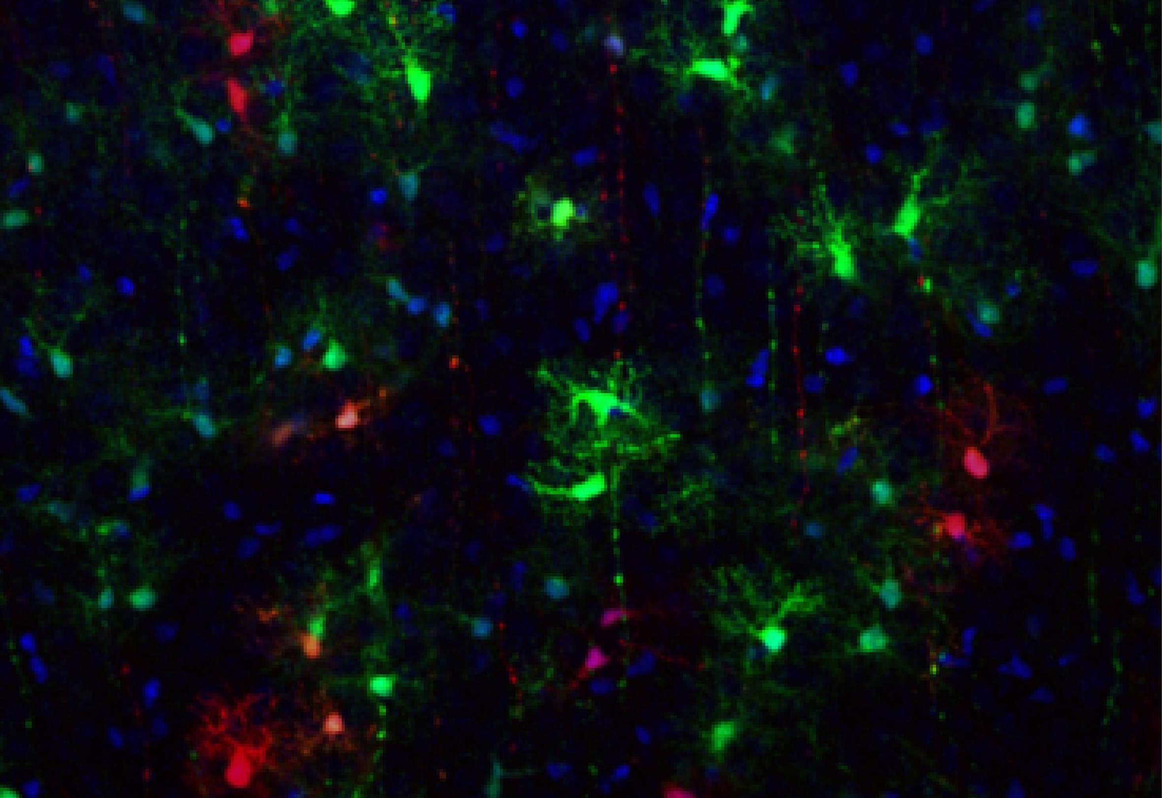 Researchers at the University of Geneva have uncovered that astrocytes in the brain’s cortex originate from two distinct types of progenitors, a finding that could reshape therapeutic strategies for neurological disorders.