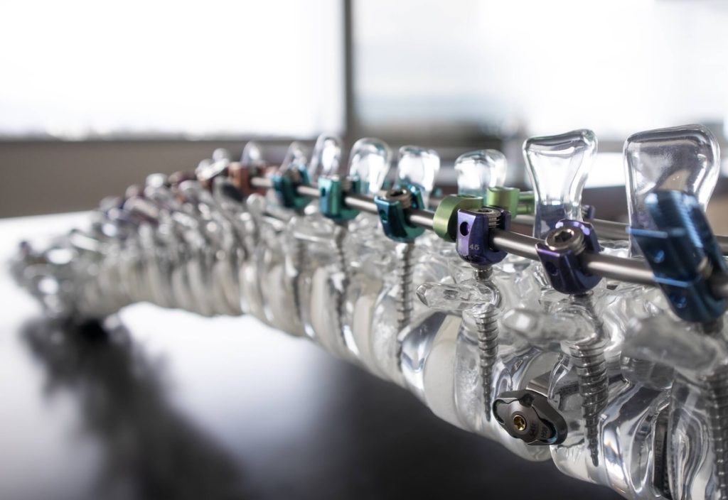 La medtech genevoise Spineart a obtenu un investissement de CHF 25 millions auprès de ses actionnaires historiques Gimv et EGS Beteiligungen (EGSB), afin de soutenir sa prochaine phase de croissance et d’expansion internationale.