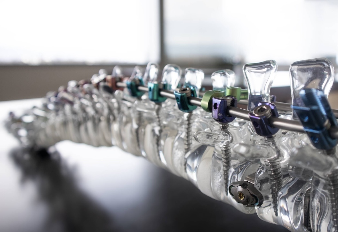 La medtech genevoise Spineart a obtenu un investissement de CHF 25 millions auprès de ses actionnaires historiques Gimv et EGS Beteiligungen (EGSB), afin de soutenir sa prochaine phase de croissance et d’expansion internationale.