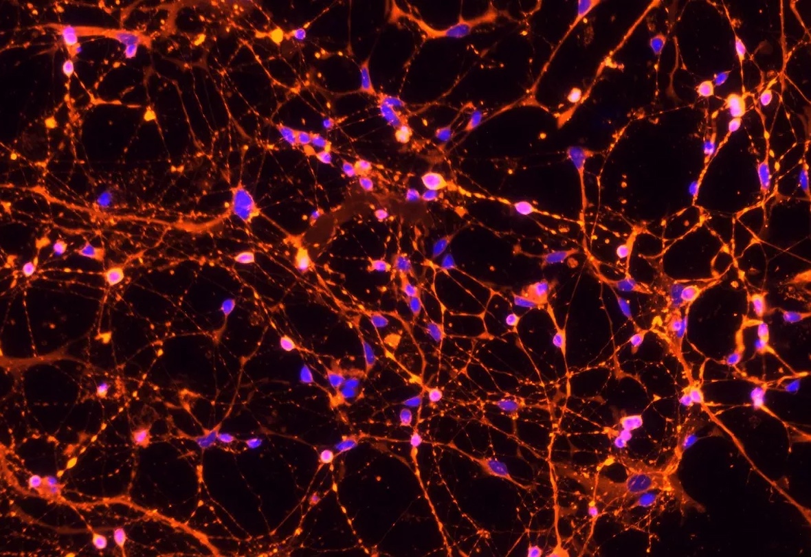 Researchers at CHUV have validated a new stem-cell–based method to study autoimmune diseases in organs such as the brain, offering new insights into conditions like autoimmune encephalitis and multiple sclerosis.