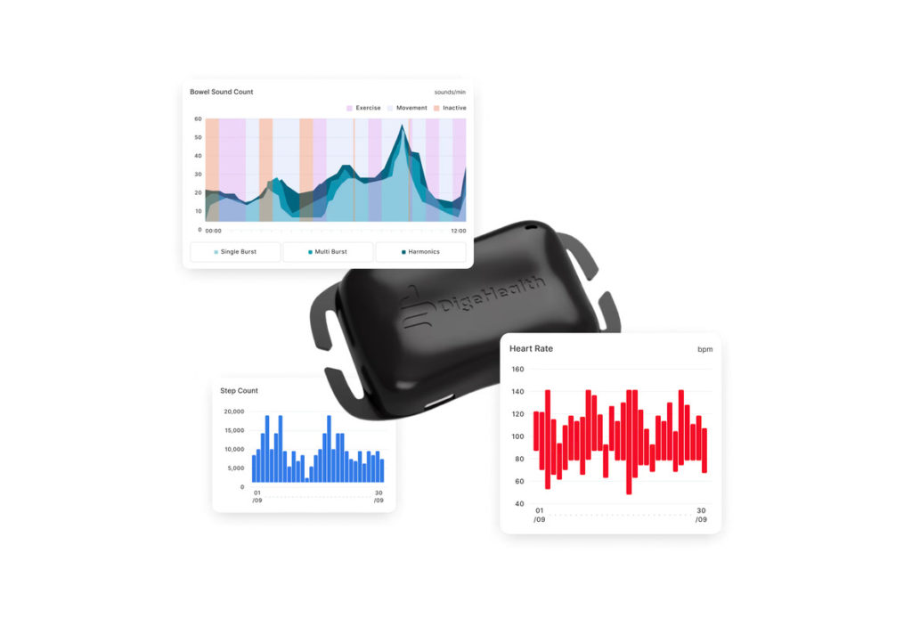 DigeHealth has raised CHF 1.25 million to accelerate the development of a wearable device that continuously monitors gastrointestinal activity using acoustics and artificial intelligence.