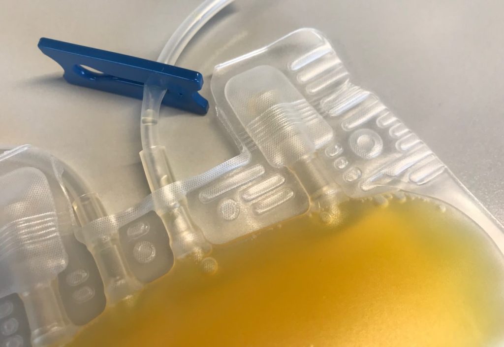 HemostOD has been awarded a CHF 2 million Innosuisse grant to support the preclinical development of its donor-free, off-the-shelf human blood platelets for transfusion.