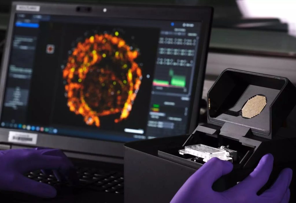 AC Immune a amendé son accord de licence et de collaboration avec Eli Lilly pour faire avancer de nouveaux candidats petites molécules Tau Morphomer contre la maladie d'Alzheimer et d'autres maladies neurodégénératives, avec le lancement des études permettant le dépôt d'un IND prévu au premier semestre 2026.