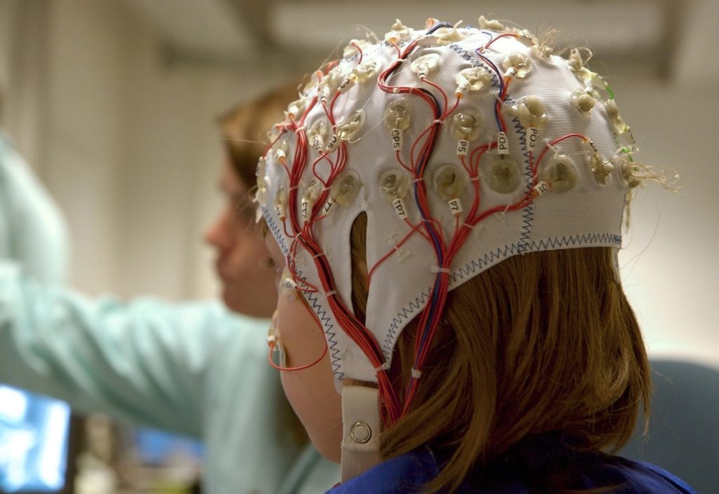 Geneva-based dEEGtal has appointed neurotechnology entrepreneur and investor Ann Bunnenberg to its board of directors, as the AI-powered brain signal platform advances clinical studies across Switzerland, Spain, and the United States ahead of a CHF 4–5 million seed round.