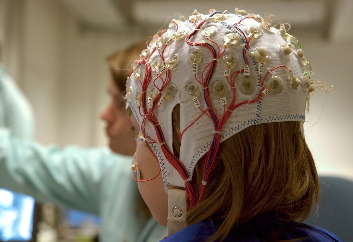 Geneva-based dEEGtal has appointed neurotechnology entrepreneur and investor Ann Bunnenberg to its board of directors, as the AI-powered brain signal platform advances clinical studies across Switzerland, Spain, and the United States ahead of a CHF 4–5 million seed round.